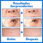 ¡NUEVO PRODUCTO! Botox Stock Solution Serum Facial